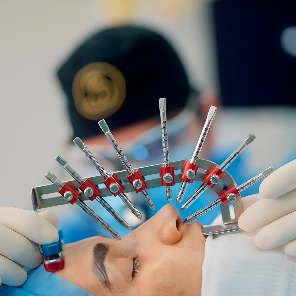 Como Escolher a Melhor Clínica de Rinoplastia